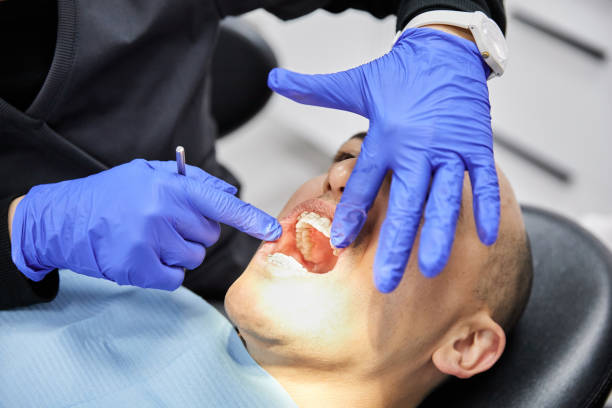 Best Emergency Treatment for Dental Infections or Abscesses in East Foothills, CA