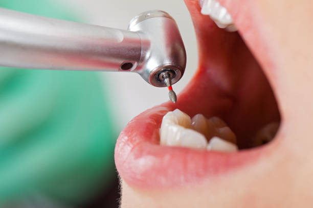 Best After-Hours Dental Trauma Care in East Foothills, CA